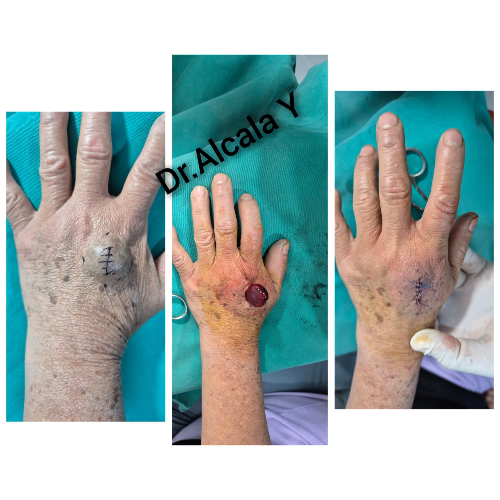 Download free bootstrap 4 admin dashboard, free boootstrap 4 templates